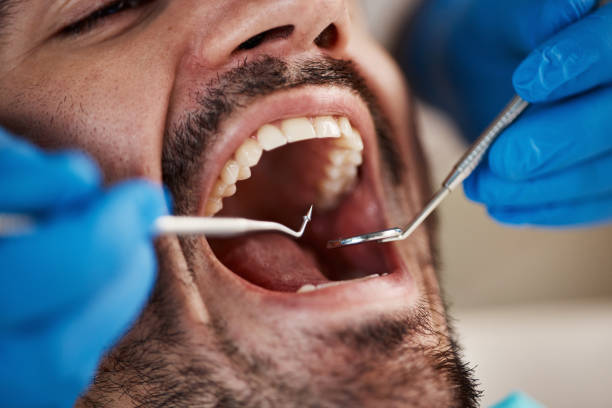 Oral Surgery in Niles, MI